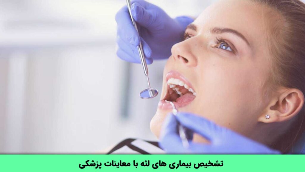 تشخیص بیماری های لثه با معاینات پزشکی