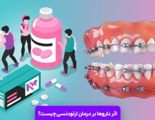 اثر داروها بر درمان ارتودنسی چیست؟