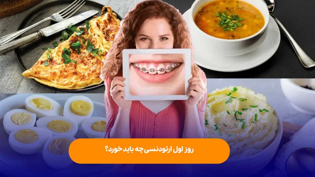 روز اول ارتودنسی چه باید خورد؟