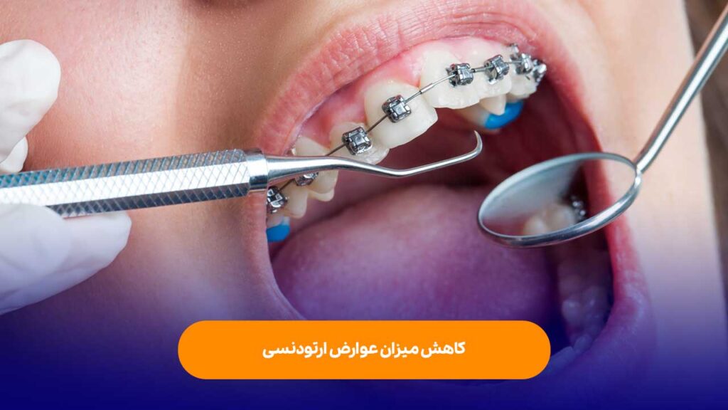 بیماری لثه و حساسیت دندان ها به براکت و بریس های ارتودنسی